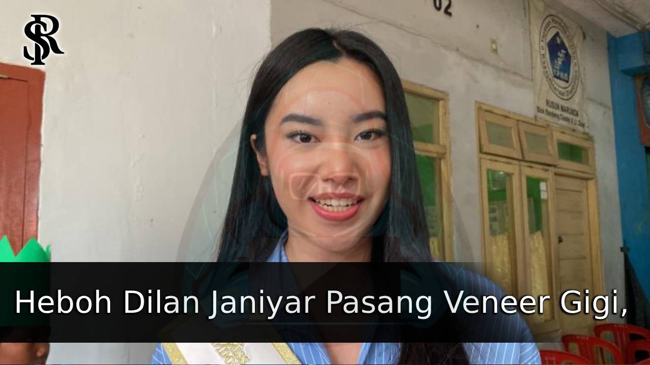 Heboh Dilan Janiyar Pasang Veneer Gigi, Netizen: “Hilang Rasa Bersyukur!”